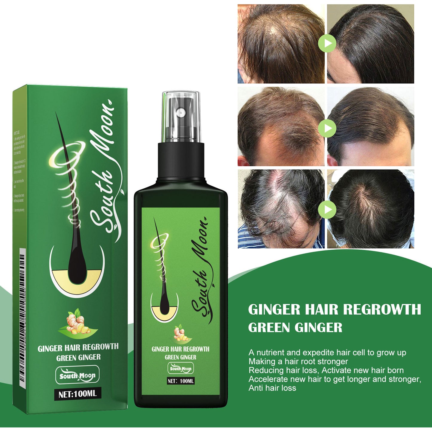💓Christmas Special: Limited-time 50% discount✨✨Ginger Nourishing Hair Growth Spray (Specially Designed for Hair Loss Prevention)