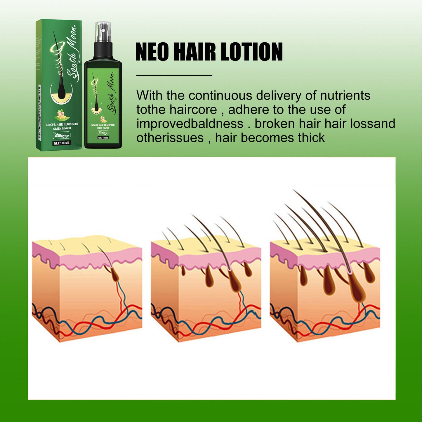 💓Christmas Special: Limited-time 50% discount✨✨Ginger Nourishing Hair Growth Spray (Specially Designed for Hair Loss Prevention)