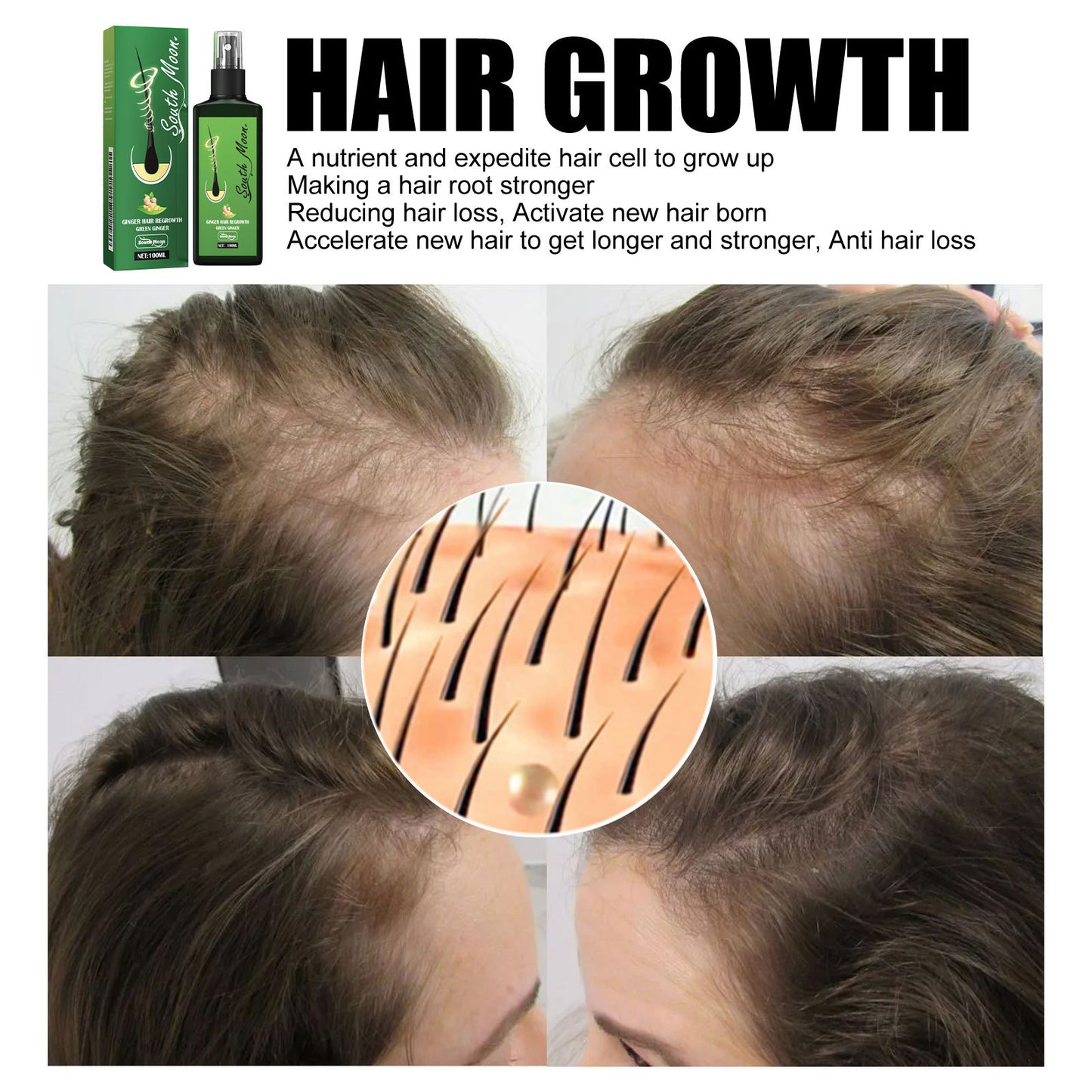 💓Christmas Special: Limited-time 50% discount✨✨Ginger Nourishing Hair Growth Spray (Specially Designed for Hair Loss Prevention)