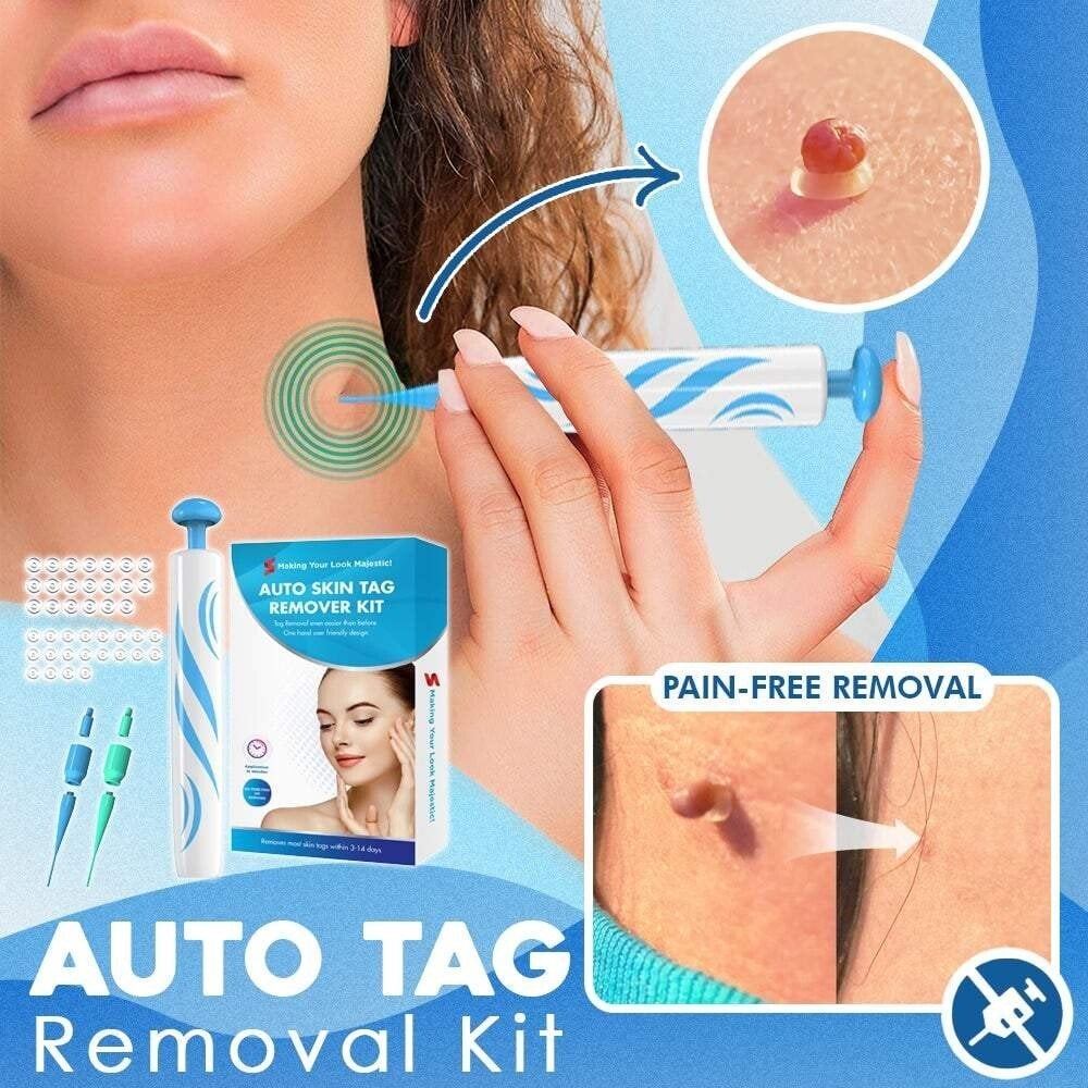 fast auto tag removal kit