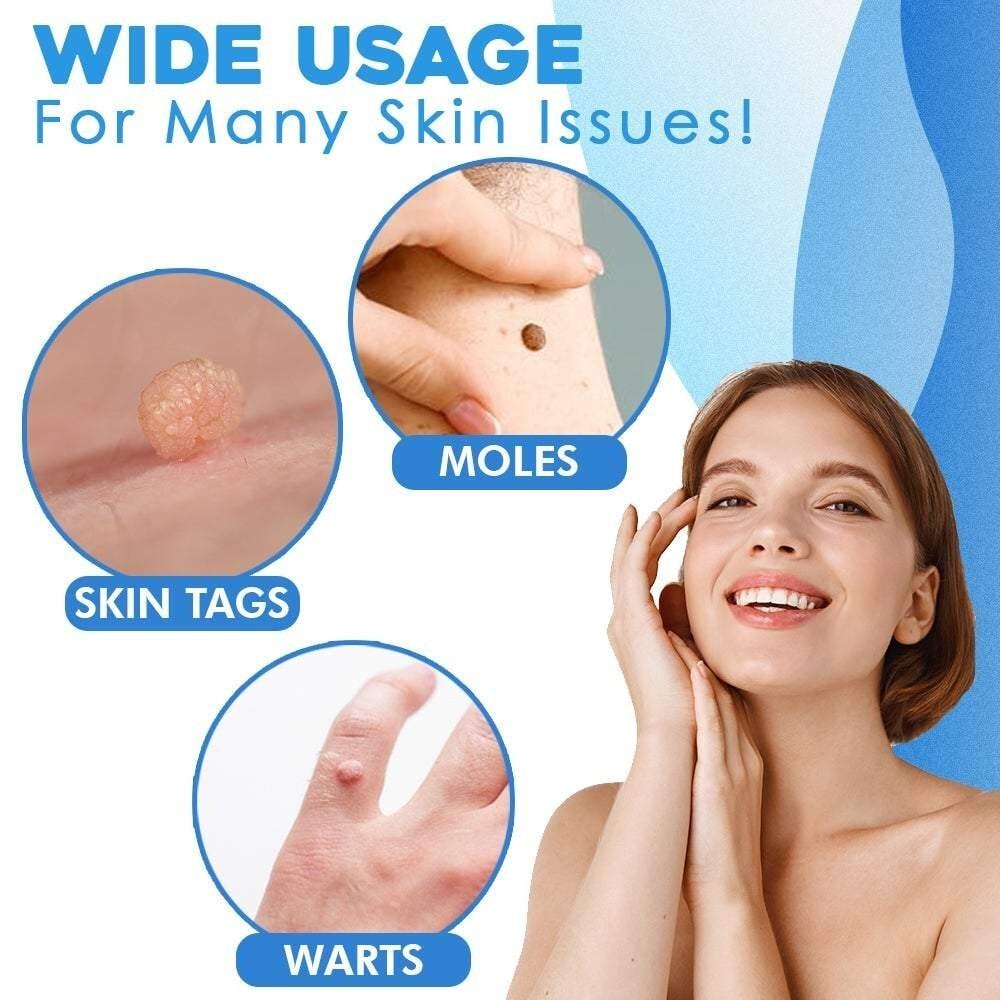 fast auto tag removal kit