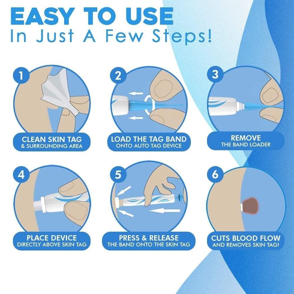 fast auto tag removal kit