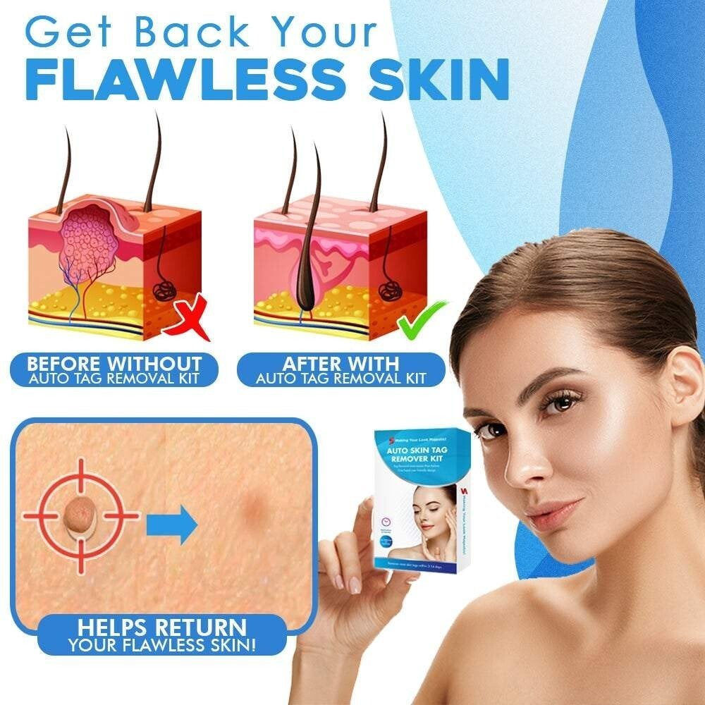 fast auto tag removal kit