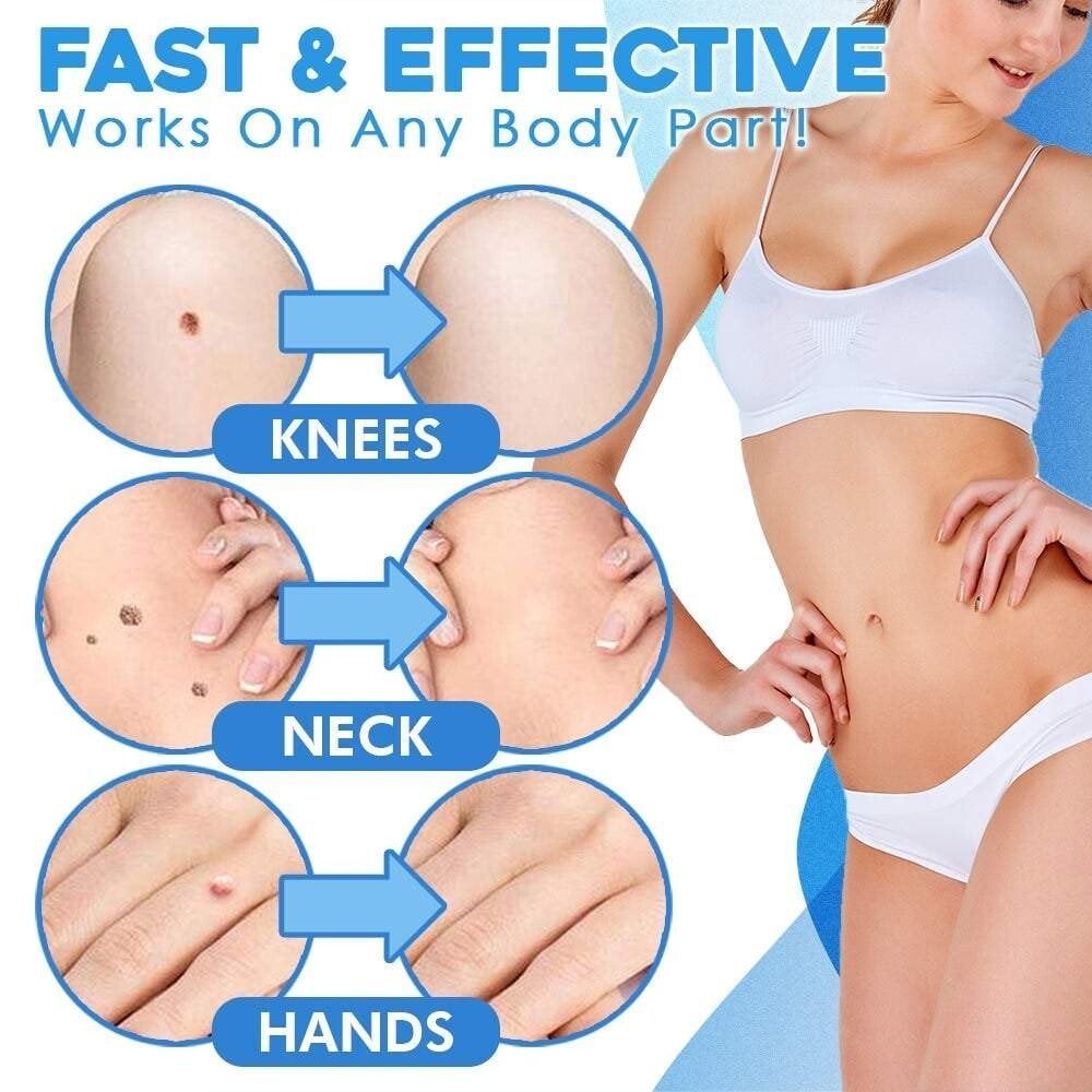 fast auto tag removal kit