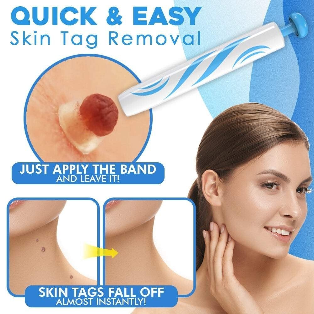 fast auto tag removal kit